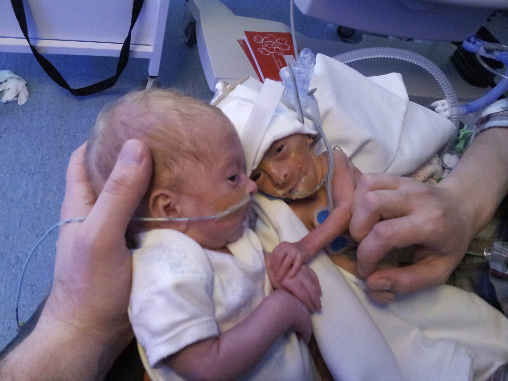 Two Trimesters and No Time to Think (With prematurity, forewarned is not necessarily forearmed)