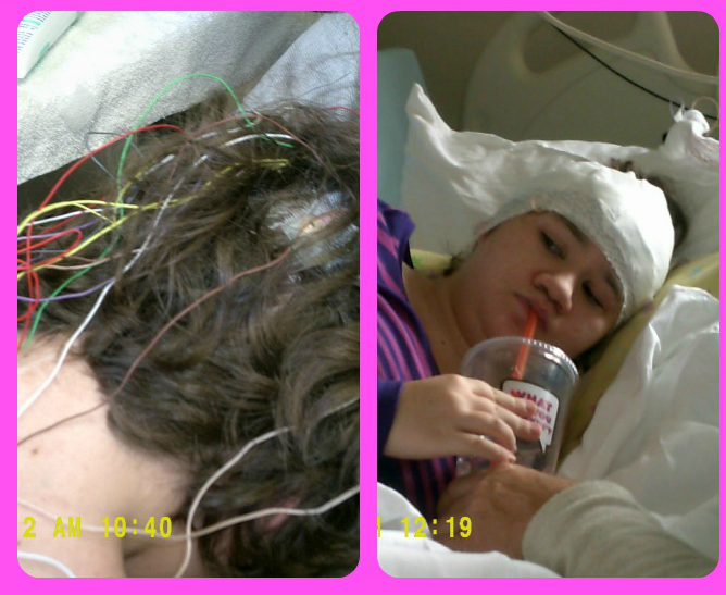 Dangerous and Annoying Epilepsy Misconceptions
