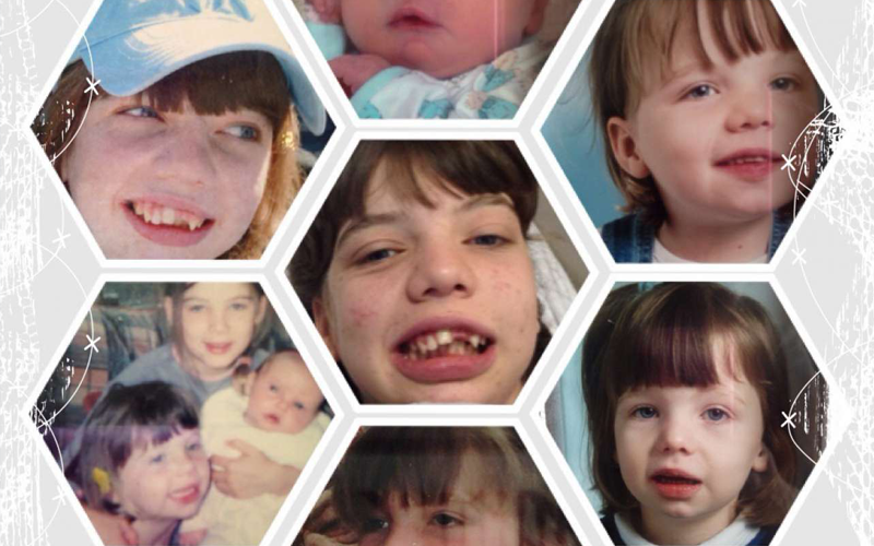 Epilepsy: The Jigsaw Destroyer
