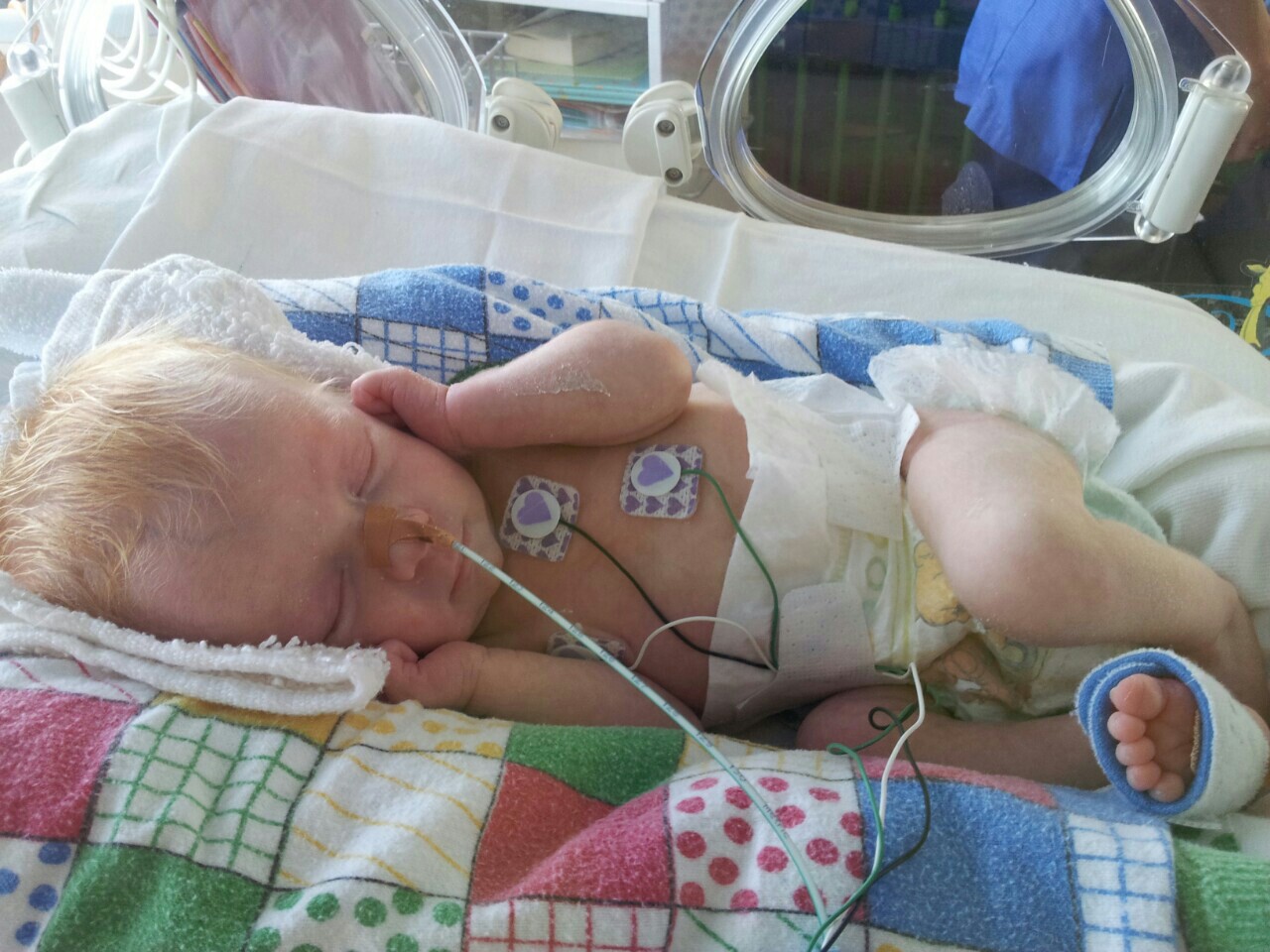 Prematurity - Our Story