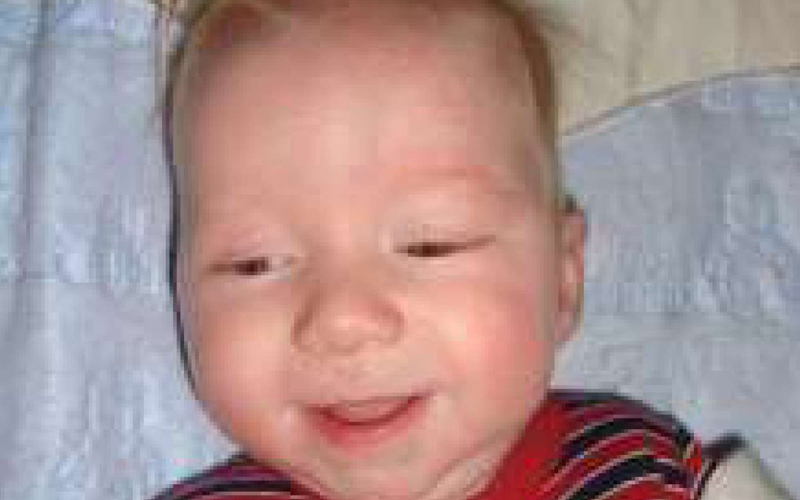 Epilepsy: The Sneak